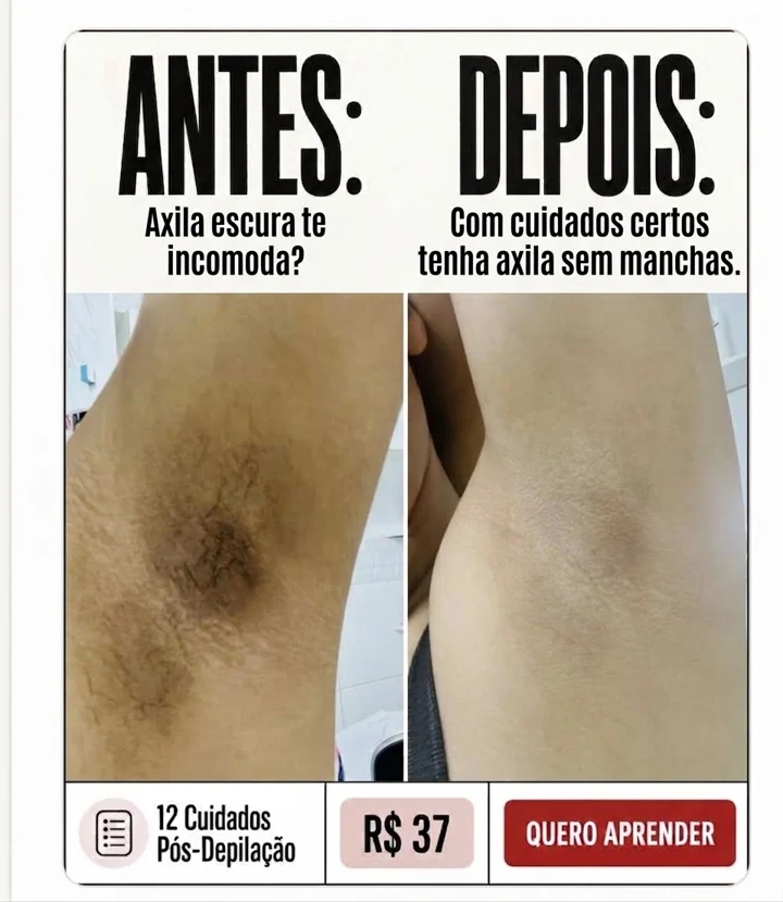 Prévia original recebida: Antes e depois de axilas